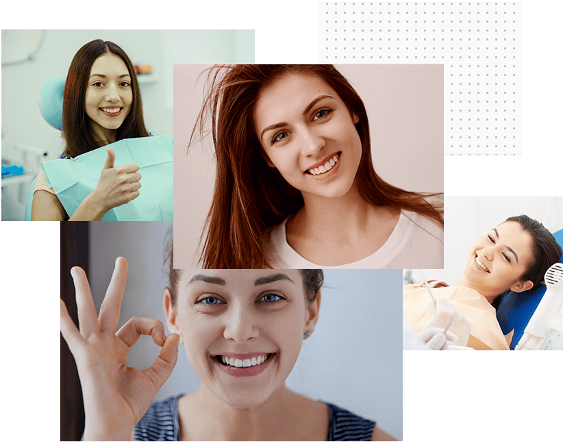 Dental Veneers Image 2